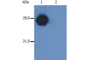Western Blotting analysis of MHC Class II in whole cell lysate of RAJI human Burkitt lymphoma cell line using anti-human HLA-DR+DP (MEM-136). (HLA-DP/DR antibody  (PE))