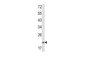 Western blot analysis of PS Antibody (Center) (ABIN652603 and ABIN2842405) in mouse spleen tissue lysates (35 μg/lane). (PSMA7 antibody  (AA 100-126))