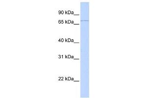 Western Blotting (WB) image for anti-RING Finger Protein 6 (RNF6) antibody (ABIN2458701) (RNF6 antibody)