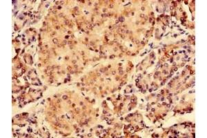 Immunohistochemistry of paraffin-embedded human pancreatic tissue using ABIN7147383 at dilution of 1:100 (CEP126 antibody  (AA 559-670))