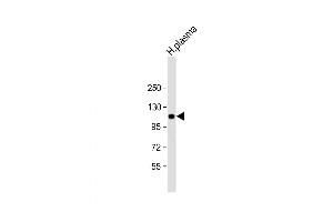 Western Blot at 1:2000 dilution + human plasma lysate Lysates/proteins at 20 ug per lane. (ITIH4 antibody  (AA 784-816))