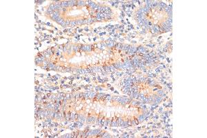 Immunohistochemistry of paraffin-embedded human appendix using WNK3 antibody (ABIN6132518, ABIN6150236, ABIN6150237 and ABIN6221221) at dilution of 1:100 (40x lens). (WNK3 antibody)