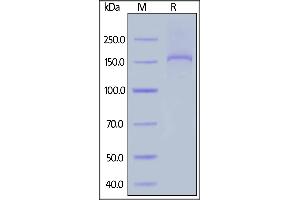 Human Thrombospondin-2, His Tag on  under reducing (R) condition. (Thrombospondin 2 Protein (THBS2) (AA 19-1172) (His tag))