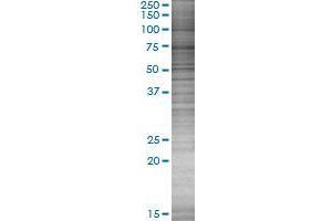 SLC37A3 transfected lysate. (SLC37A3 293T Cell Transient Overexpression Lysate(Denatured))