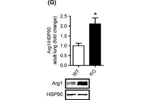 Western Blotting (WB) image for anti-Arginase, Liver (ARG1) antibody (ABIN2856661)