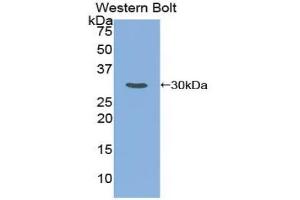 Western blot analysis of the recombinant protein. (SMAD6 antibody  (AA 261-495))