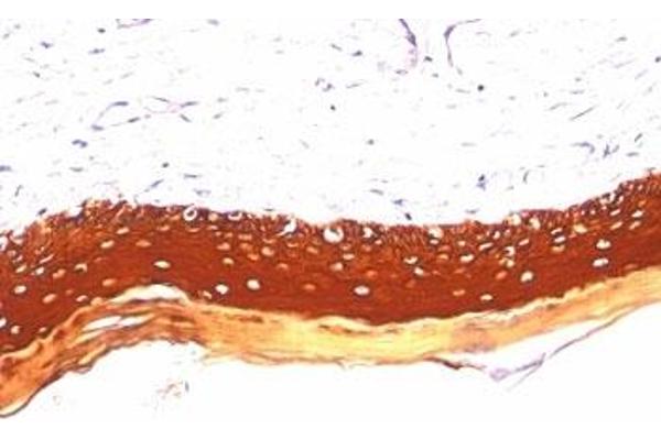 Keratin Acidic (AE1) antibody