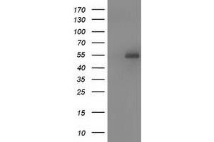 HEK293T cells were transfected with the pCMV6-ENTRY control (Left lane) or pCMV6-ENTRY SNTA1 (Right lane) cDNA for 48 hrs and lysed. (SNTA1 antibody)