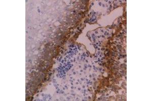 Immunohistochemistry (IHC) image for anti-Integrin beta 4 (ITGB4) antibody (ABIN2478034) (Integrin beta 4 antibody)