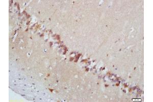 Formalin-fixed and paraffin embedded mouse brain labeled with Rabbit Anti-MAPKAPK2 (Thr222) Polyclonal Antibody, Unconjugated  at 1:200 followed by conjugation to the secondary antibody and DAB staining (MAPKAP Kinase 2 antibody  (pThr222))