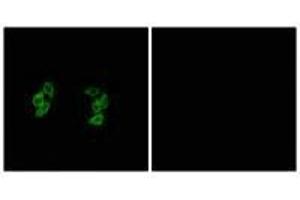 Immunofluorescence analysis of A549 cells, using CKI-α1/L antibody. (CSNK1A1L/CSNK1A1 antibody)
