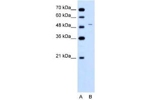 FECH antibody used at 0. (FECH antibody)