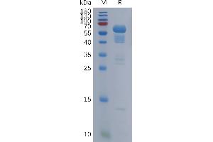 Human Protein, His Tag on SDS-PAGE under reducing condition. (SCG3 Protein (AA 20-468) (His tag))