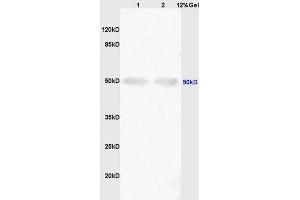 SDS-PAGE (SDS) image for anti-Sonic Hedgehog (SHH) (AA 21-120) antibody (ABIN731108)