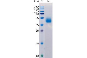 Human MICB Protein, His Tag on SDS-PAGE under reducing condition. (MICB Protein (AA 23-309) (His tag))
