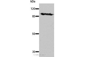 Western blot analysis of Mouse brain tissue, using DNM1 Polyclonal Antibody at dilution of 1:700 (Dynamin 1 antibody)
