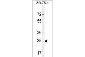 Western blot analysis in ZR-75-1 cell line lysates (35ug/lane). (NDUFAF1 antibody  (C-Term))