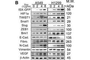 Western Blotting (WB) image for anti-Vimentin (VIM) antibody (ABIN2854814)