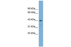 SAMSN1 antibody used at 1 ug/ml to detect target protein. (SAMSN1 antibody  (Middle Region))