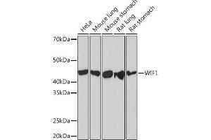 Western blot analysis of extracts of various cell lines, using WIF1 Rabbit mAb (ABIN7271383) at 1:1000 dilution. (WIF1 antibody)