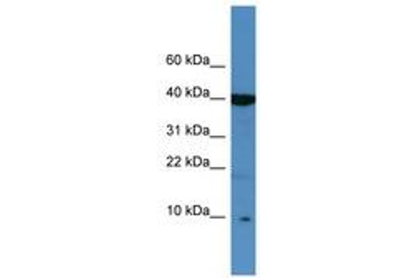 SPINK6 antibody  (C-Term)