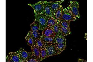 Immunocytochemistry (ICC) image for anti-Transferrin Receptor (p90, CD71) (TFRC) antibody (ABIN94221)