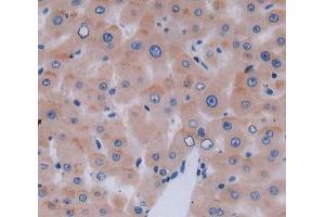 Used in DAB staining on fromalin fixed paraffin- embedded Kidney tissue (TUBA3C antibody  (AA 1-300))