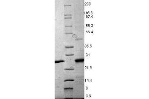 EBI3 Protein