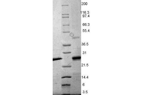 EBI3 Protein