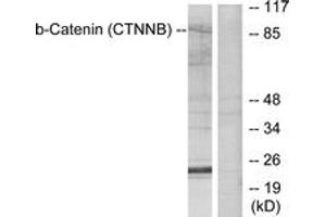 Western blot analysis of extracts from SW626 cells, using Catenin-beta (Ab-41/45) Antibody. (beta Catenin antibody  (AA 11-60))