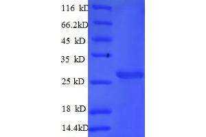 SDS-PAGE (SDS) image for Cathepsin S (CTSS) (AA 123-340) protein (His tag) (ABIN5709371) (Cathepsin S Protein (CTSS) (AA 123-340) (His tag))