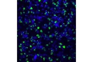 HL60 cells treated with DMSO and Calcimycin. (Histone 3 antibody  (ciArg2, ciArg8, ciArg17))