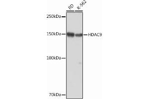 Western blot analysis of extracts of various cell lines, using HD Rabbit mAb (ABIN1680476, ABIN3015870, ABIN3015871 and ABIN7101453) at 1:1000 dilution. (HDAC9 antibody)