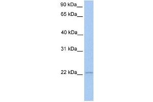 ISG20 antibody used at 1 ug/ml to detect target protein. (ISG20 antibody  (Middle Region))