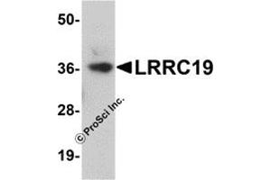 Western Blotting (WB) image for anti-Leucine Rich Repeat Containing 19 (LRRC19) (C-Term) antibody (ABIN1030493) (LRRC19 antibody  (C-Term))