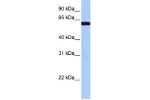 WB Suggested Anti-RBM14 Antibody Titration:  0. (RBM14 antibody  (N-Term))