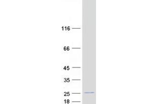 POLR1D Protein (Transcript Variant 2) (Myc-DYKDDDDK Tag)