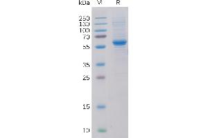 Human Protein, His Tag on SDS-PAGE under reducing condition. (ROR2 Protein (AA 34-403) (His tag))