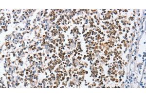 Immunohistochemistry of paraffin-embedded Human tonsil using MCM6 Polyclonal Antibody at dilution of 1:45 (MCM6 antibody)