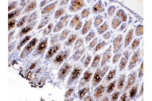 IHC analysis of TFF2 using anti-TFF2 antibody . (Trefoil Factor 2 antibody  (AA 24-129))