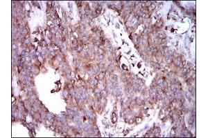 Immunohistochemistry (IHC) image for anti-Signal Transducer and Activator of Transcription 5A (STAT5A) (AA 583-794) antibody (ABIN1098129)