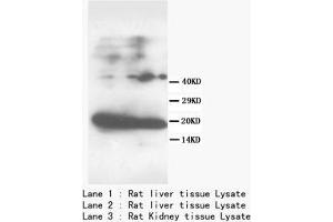 FABP1 Polyclonal Antibody (FABP1 antibody  (N-Term))