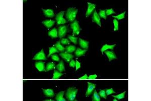 Immunofluorescence analysis of HeLa cells using MSRB1 Polyclonal Antibody (MSRB1 antibody)