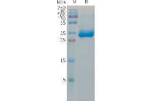 Mouse HistoneH1. (HIST1H1C Protein (Fc Tag))