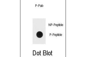 Dot Blot (DB) image for anti-Mitogen-Activated Protein Kinase 1/3 (MAPK1/3) (pThr202), (pTyr204) antibody (ABIN3001885) (ERK1/2 antibody  (pThr202, pTyr204))