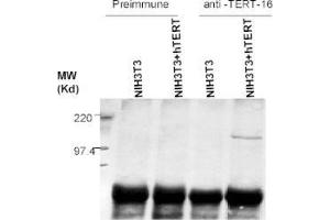 Western Blotting (WB) image for anti-Telomerase Reverse Transcriptase (TERT) (C-Term) antibody (ABIN6655122)