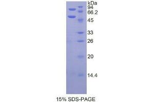 SDS-PAGE analysis of Mouse Protein C Protein. (PROC Protein)