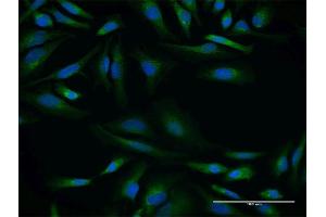 Immunofluorescence of purified MaxPab antibody to SPINT2 on HeLa cell. (SPINT2 antibody  (AA 1-252))