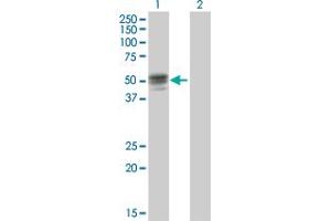 Western Blot analysis of GIF expression in transfected 293T cell line by GIF MaxPab polyclonal antibody. (Intrinsic Factor antibody  (AA 1-417))