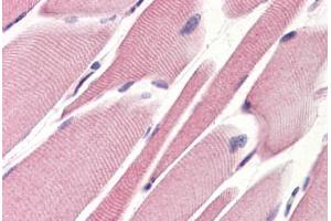 Human Skeletal Muscle (formalin-fixed, paraffin-embedded) stained with STEAP1 antibody ABIN364397 at 10 ug/ml followed by biotinylated anti-mouse IgG secondary antibody ABIN481714, alkaline phosphatase-streptavidin and chromogen. (STEAP1 antibody  (AA 1-70))